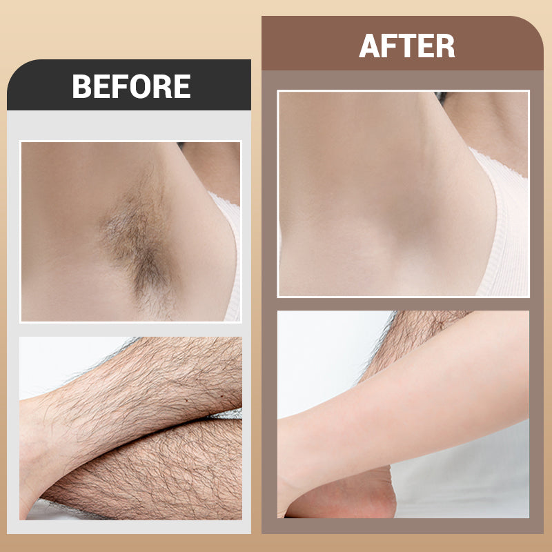 🌈120g gentle hair removal cream, suitable for multiple body parts💥