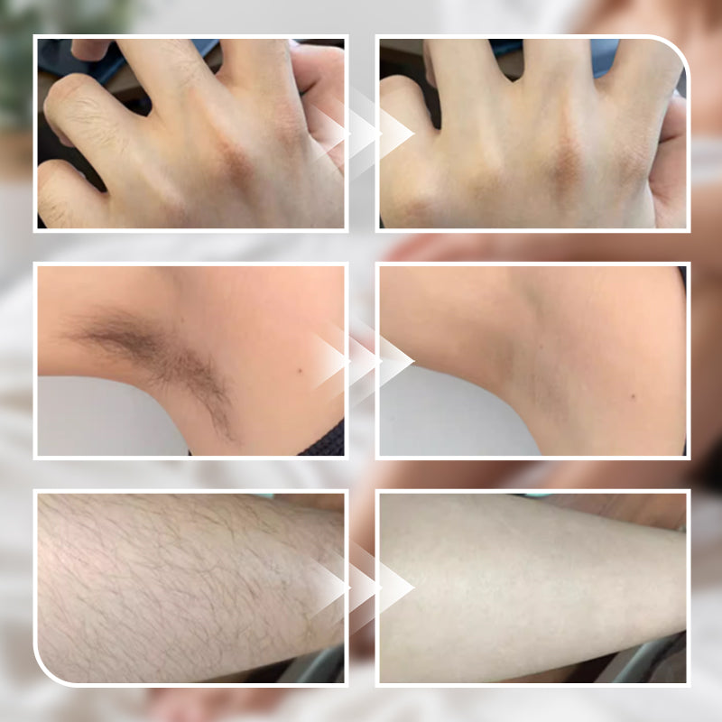 🔥Buy 2 and get 1 free 🎁Gentle Depilatory Cream for Men and Women