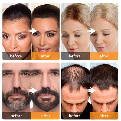 🔥2025 Year Hot Sale 50% OFF 🔥Hairline Powder | Root Cover Up For Effortless Beauty