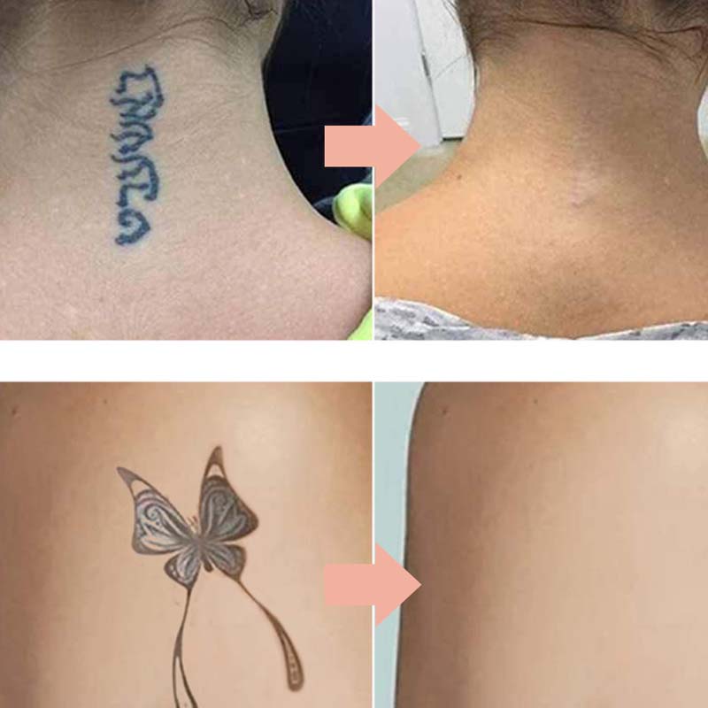 🧼LAST DAY - BUY 2 GET 1 FREE🖍️🎁 Gentle Effective Multi-Use Tattoo Fading Cream