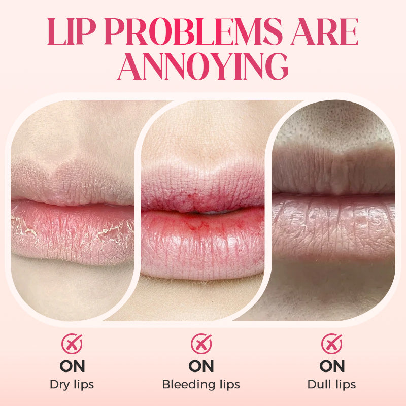 ⏳2026 NEW YEAR BUY 1 GET 1 FREE⚡50K+ SOLD!✨Nooni Apple Hydrating Moisturizer Plump Transfer-proof Glossy Lip Stain Oil💋